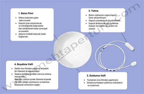 Yutulabilir Mide Balonu Nedir Allurion Mide Balonu Fiyatı