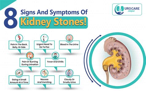 Tanda Batu Karang Kidney Stone Yang Ramai Pandang Remeh