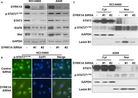 Dyrk1a Regulates Stat3egfrmet Signalling In Egfr Wild‐type Nsclc