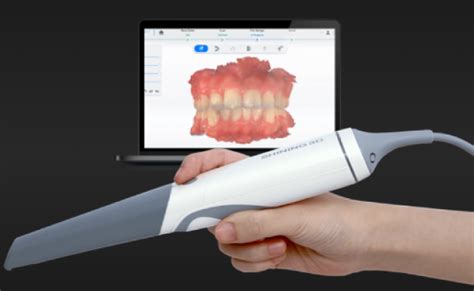 Scanner Intraoral Shining 3D Aoralscan 3 Loja Sintetize3D