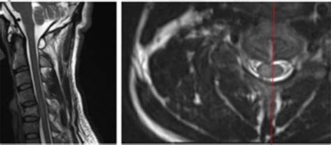 Diagnostic Imaging Exam Pictures Flashcards Quizlet