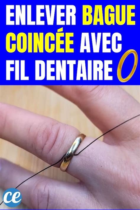 Comment Enlever Une Bague Coinc E Avec Un Simple Fil Dentaire