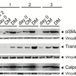 Expression Of Contractile SMC Specific Proteins Analyzed By Western