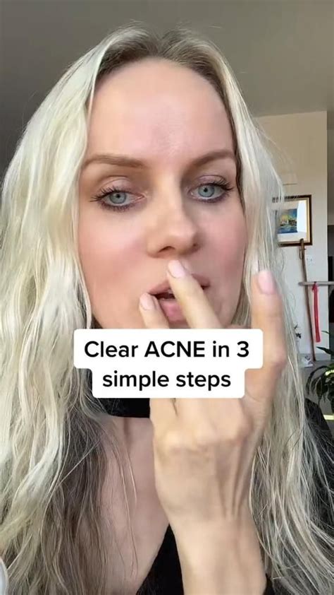 Clear Acne In 3 Simple Steps Natural Skin Care Clear Acne Healthy Skin