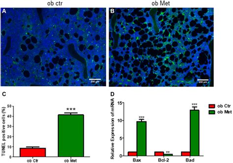 Metformin Increases Bone Marrow Adipose Tissue By Promoting Mesenchymal