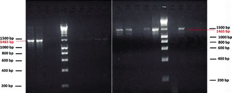 Gel Electrophoresis Image Of The 16s Rrna Gene Region Which Yielded