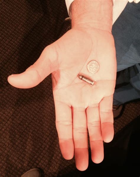 Oklahoma City Man Is Implanted With Worlds Smallest Pacemaker