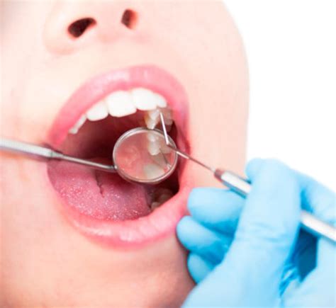 Periodoncia CLINICA DENTAL VIGO RIOSDENT