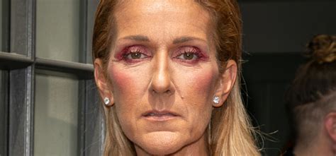 Celine Dion Condition Continues To Deteriorate She Cancels Her Entire World Tour