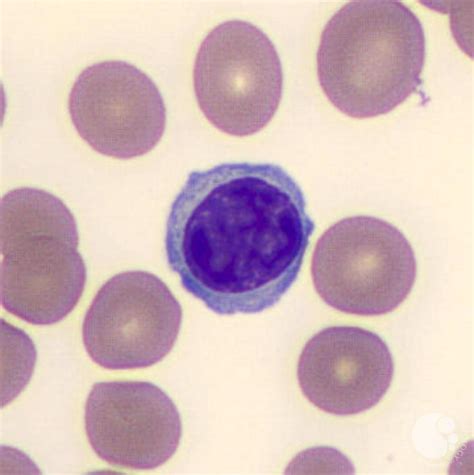 Lymphocyte