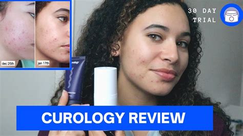 I Tried Curology For 30 Days For My Acne Review And Results Youtube