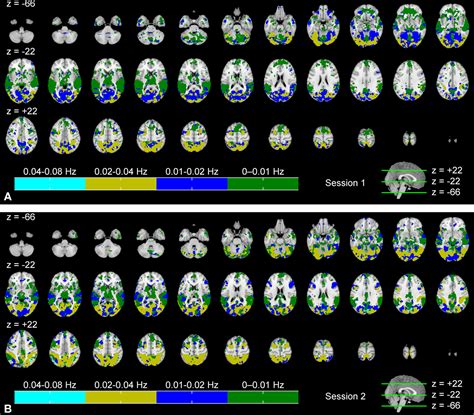 Frontiers Inter Subject Correlation Of Brain Hemodynamic Responses