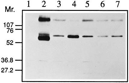 Expression Of Mammalian Nramp Proteins In Yeast Saccharomyces