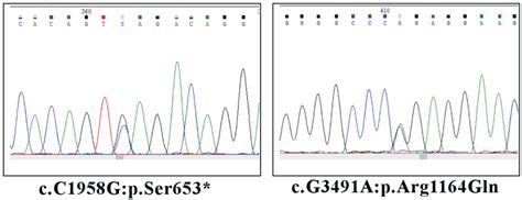 Validation Of Ngs Alpk Variants By Sanger Sequencing Alpk