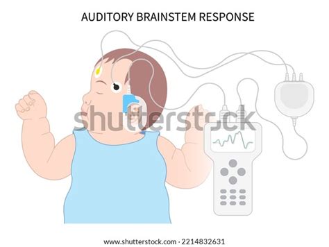 2 Brainstem Evoked Response Audiometry Images Stock Photos Vectors