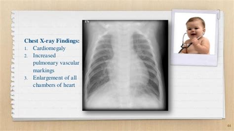 A Cyanotic Congenital Heart Diseases