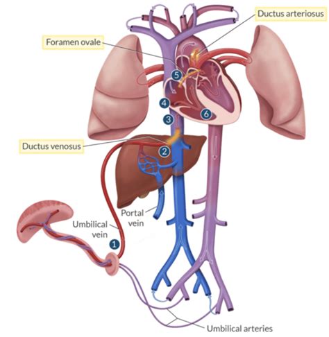 Congenital Heart Disease Flashcards Quizlet