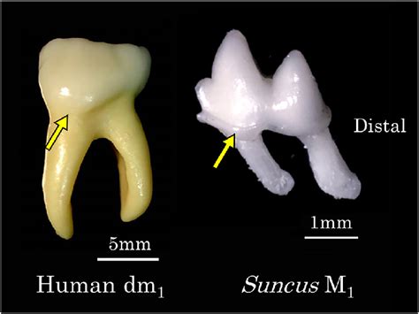 Cingulum Tuberculum Molare Mesiobuccal Ridge In A Human Mandibular