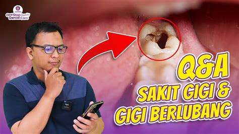 Sakit Gigi Pasti Karena Gigi Berlubang Q A Aja Sama Dokternya Langsung