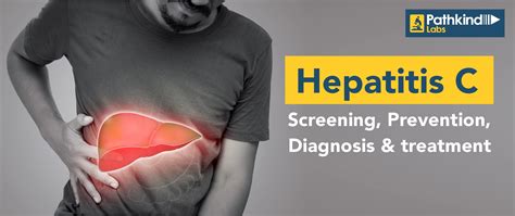 Hepatitis C Guide Screening To Treatment