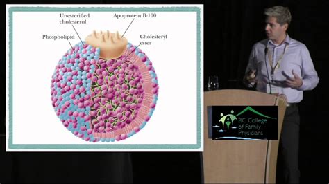 Lipids Beyond The Guidelines What Is The Real World Practical