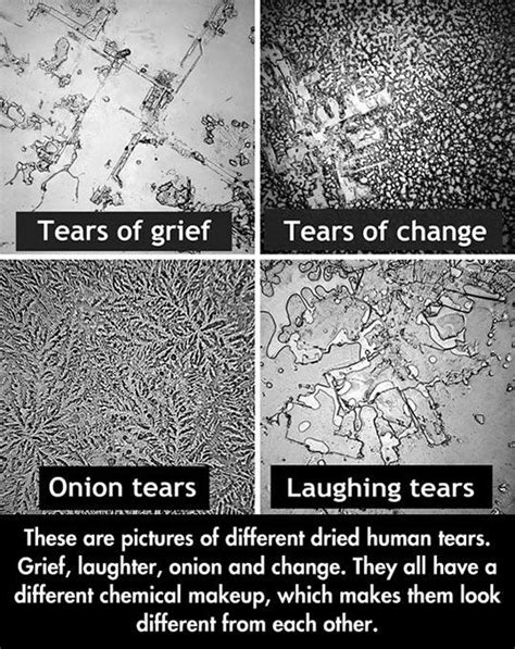 Tears Structure Things Under A Microscope