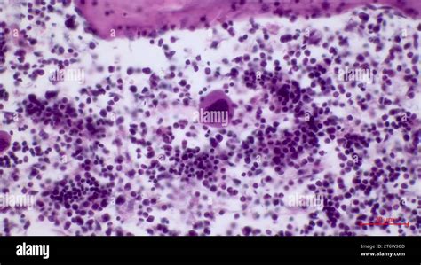 Microscopic Structure Of Red Bone Marrow Histologythe Largest Cell In