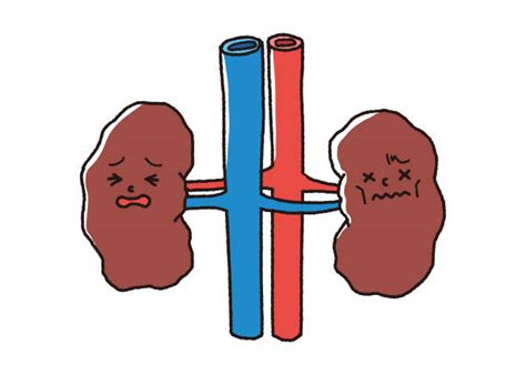 Kidney Disease Illustrations, Royalty-Free Vector Graphics & Clip Art ...