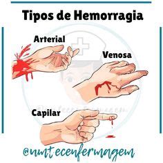 12 Ideias De Terminologias De Enfermagem Terminologias De Enfermagem