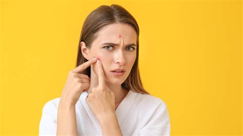 8 Harmful Cosmetic Ingredients That Can Cause Acne Healthshots