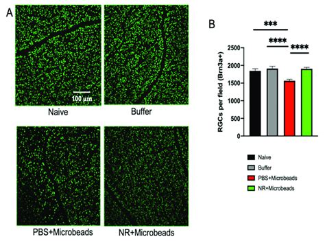 Nr Treatment Prevents Rgc Loss Following Microbead Injection A