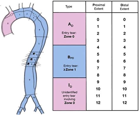 Computed Tomography Angiography Assessment Of Acute Aortic Syndromes