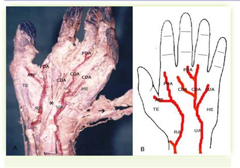 Palmar Arch Study