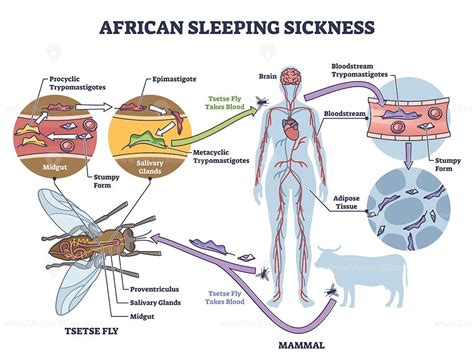 African Sleeping Sickness Or African Trypanosomiasis Illustration