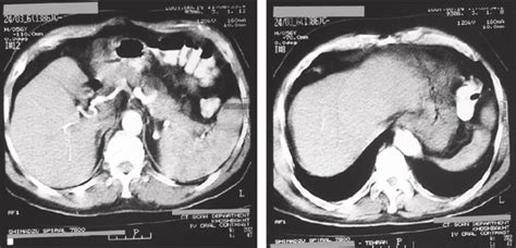 CT Scan Spiral Pelvis - Corporate Health & Wellness Specialist - PrognoHealth