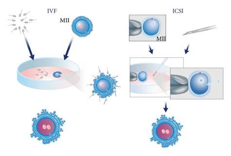 Oocyte Insemination By In Vitro Fertilization Ivf And Download