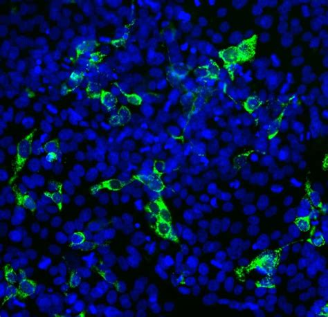 Anti-SARS-CoV-2 Spike Glycoprotein RBD antibody [2G1] (ab277624) | Abcam