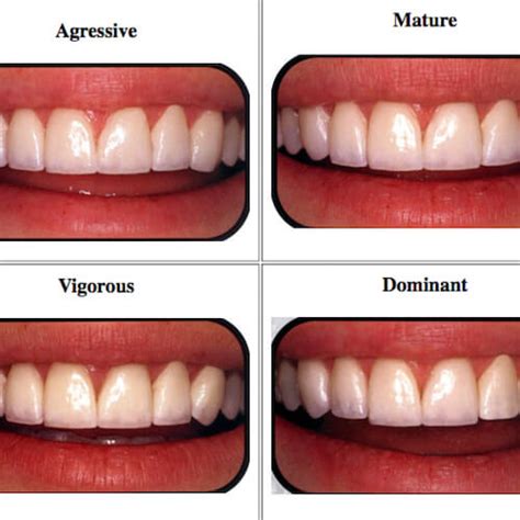 How to Choose the Best Veneers for Your Face Shape | Dr. Raanan