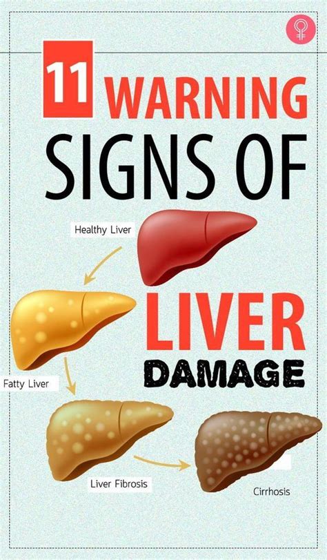 6 Warning Signs That Indicate Your Liver Is Full Of Toxins Artofit