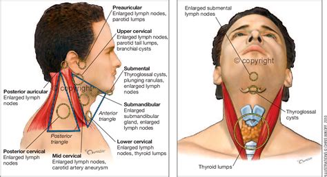 Neck Lumps A Guide To Assessment And Management Semantic Scholar