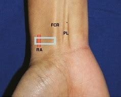 Unit Cubital Fossa Anterior Forearm Wrist Flashcards Quizlet