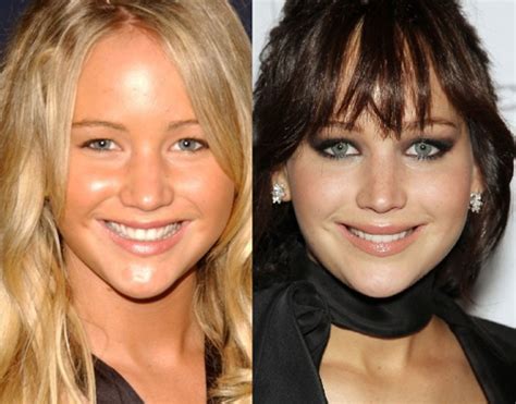 Celebrities You Didn T Realise Have Had Plastic Surgery