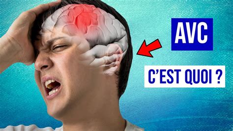 L Accident Vasculaire Cerebral Institut Du Cerveau