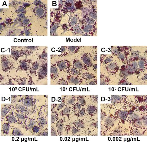 Effect Of Lp By On Lipid Deposition In Hepg Cells A Control Group