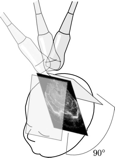 Anterior Fontanelle Sonography Using Manual Angular Sweeping A 3D