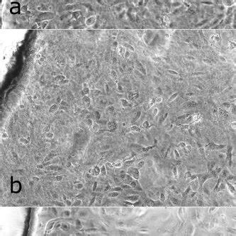 Arpe Human Retinal Pigment Epithelial Cells On A Pdlga Film