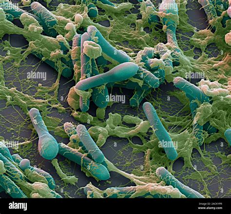 La Bacteria Clostridium Botulinum Color Análisis Micrografía De