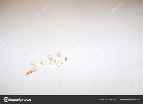 Collection of extracted milk teeth — Stock Photo © Lukassek #185572014