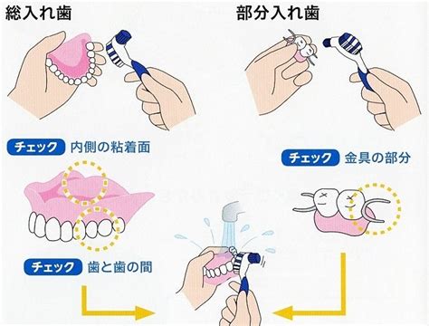 とても大切な義歯のお手入れ 第二薮本歯科医院のブログ