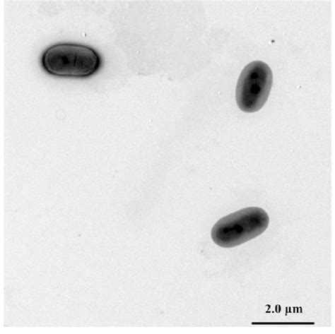 Transmission Electron Micrograph Of Strain J5 66 T Grown On Lb Agar At